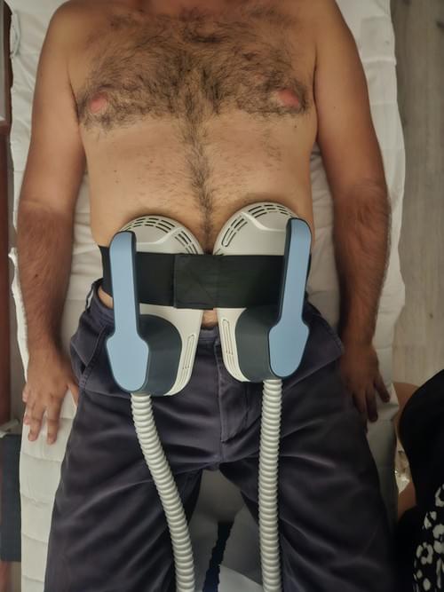 Prosculpt